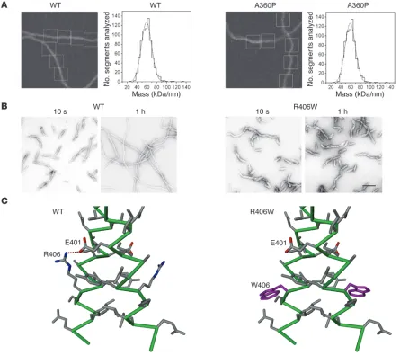 Figure 6Molecular characterization of the desmin mutants A360P and R406W. (