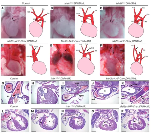 Figure 1Cardiovascular defects in Notch second heart field mutants. E17.5–P0 control (A), Islet1Cre/+;DNMAML (B and C), and Mef2c-AHF-Cre;DNMAML (D–F) mutants