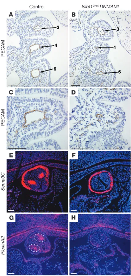 Figure 2Notch inhibition in the second heart field results in abnormal pattern-