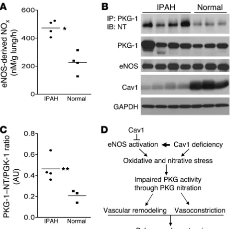 Figure 9PKG tyrosine nitration in lung tissue from IPAH patients. (