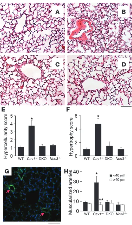 Figure 3Prevention of pulmonary vascular remodeling induced by 