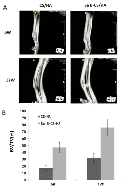 Figure 10 CT images and analysis of new bone formation.while the bone defect was still obvious in Group CS/HA