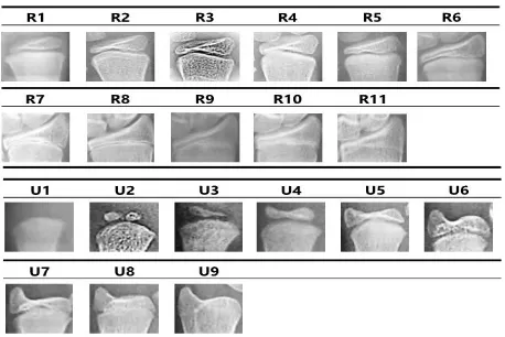 Fig 1: Left hand radiographs with respect to different positions and resolutions 