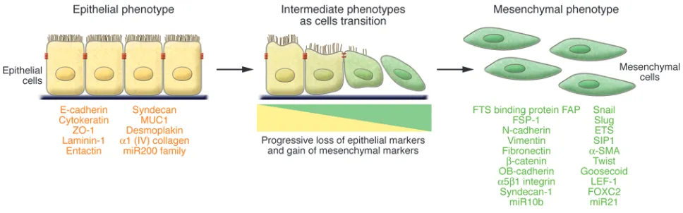 Figure 1EMT. An EMT involves a functional transition of polarized epithelial cells into mobile and ECM component–secreting mesenchymal cells