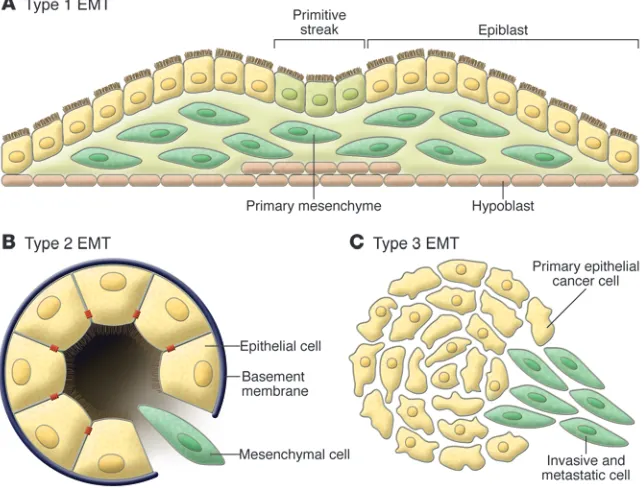 Figure 2Different types of EMT. (