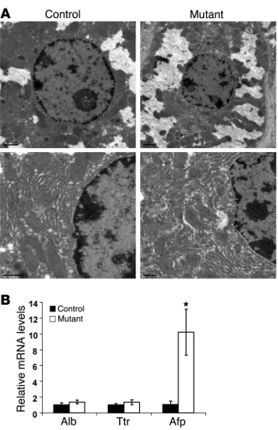 Figure 2Hepatocyte differentiation is not affected by Foxa1/2 deficiency. (