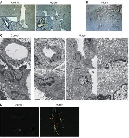 Figure 3Hepatic deficiency of Foxa1/2 results in bile duct hyperplasia. (