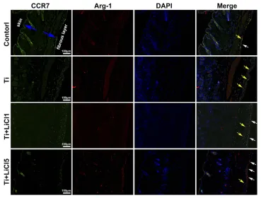 Figure 9 Images of immunoAbbreviations:Notes:ﬂuorescence staining on air-pouch tissues at day 4