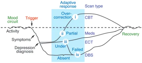 Figure 2Theoretical time course of mood circuit changes during a depressive 