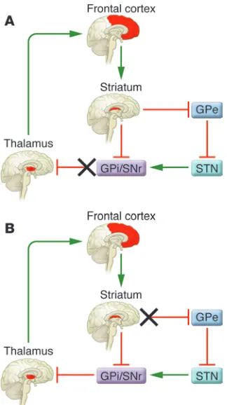 Figure 1Model for the cortico-striato-thalamo-cortical circuit dysfunction in indi-