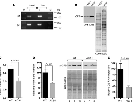 Figure 2Cfb expression in heart. (A) RT-PCR analyses using RNA show PCR products for Cfb (137 bp)