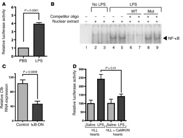 Figure 5CaMKII regulates LPS-stimulated 