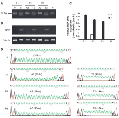 Figure 7DATE is unstable and a target of deletion mutagenesis in human breast cancer tissue and associates with high HGF expression