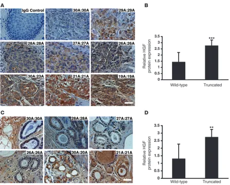 Figure 8Truncated DATE is associated with high HGF expression in human breast cancer tissues