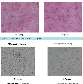Figure 1. Liver tissue from I/R and IPC group.                                             