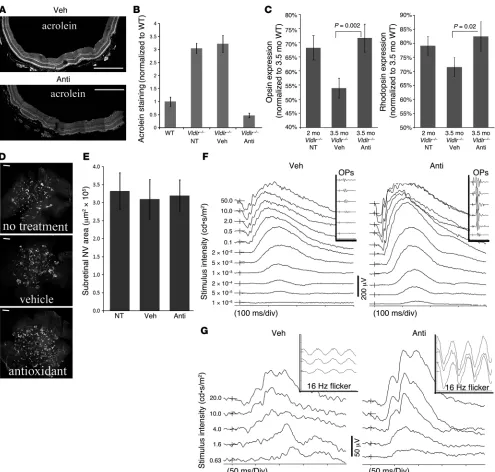 Figure 7Antioxidants protect retinas from degeneration and reduced function in 