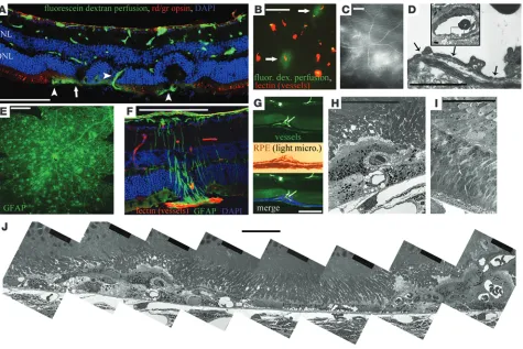 Figure 2Characterization of abnormal NV in the Vldlr–/– mouse retina. (A) Retinal cross-section montage demonstrating multiple retinal abnormalities 