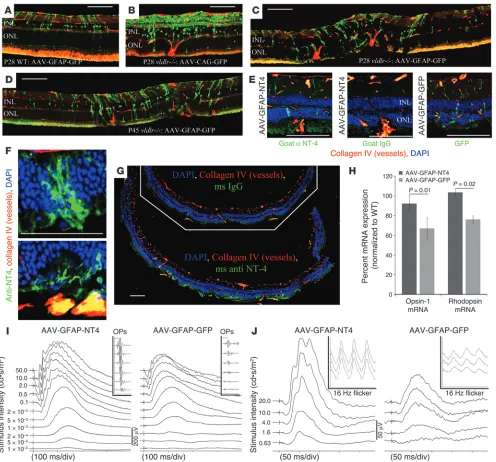 Figure 5Targeted delivery of NT4 to sites of subretinal NV protects 