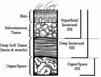 Figure 1. The anatomy of surgical site infections and their appropriate classification