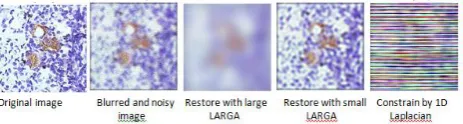Fig -5: Deblurring images using Lucy-Richardson 