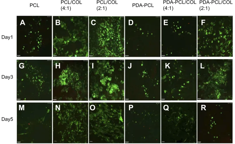 Figure 4 Cell proliferation of TSPCs using cell counting kit-8 assay. a,b,c,ep<0.05 compared with PCL; d,fp<0.05 compared with positive control.Abbreviations: TSPCs, tendon stem/progenitor cells; PCL, polycaprolactone; COL, collagen; PDA, poly(dopamine).