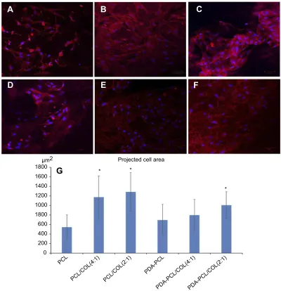 Figure 7 The cytoskeleton morphology of TSPCs using(Abbreviations: ﬂuorescence microscopy