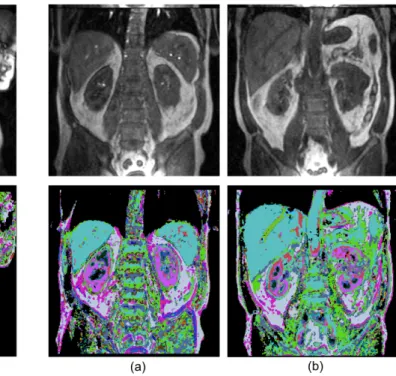 Fig. 4: Visualization of learned curve features with 16 hidden units and ρ = 0.01, β = 4 on original training data (second row), and the acquired image before the contrast enhancement (first row)