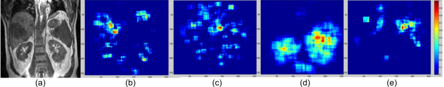 Fig. 11: Source image of a liver tumour patient (a), with probability maps for: (b) liver, (c) heart, (d) kidney, and (e) spleen.