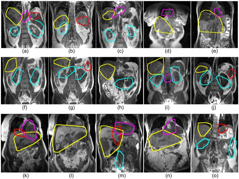 Fig. 12: Some examples of the final multi-organ detection (Yellow:liver, magenta:heart, cyan:kidney, red:spleen) on training dataset (first row), cross-validation dataset (second row), and test dataset (third row)