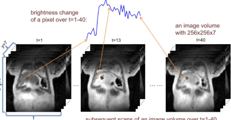 Fig. 2: A 4D DCE-MRI scan of a liver patient for a time course 1 ≤ t ≤ 40 with volume size of 256 × 256 × 7