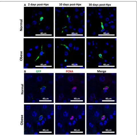 Fig. 4 Donor MSCs persist and proliferate in the liver of 70% hepatectomized mice. Normal and obese mice received 5 × 10with DAPI (immunoreactivity (Alexa Fluor 5555 MSCsGPF post-Hpx.Two, 10 and 30 days later, the presence of donor cells was evaluated by G
