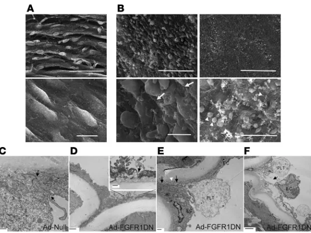 Figure 4Effect of FGF inhibition in the endothelium: electron microscopy analyses. (