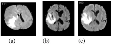 Fig.4: Segmentation of P1 into five (a), six (b), and twelve (c) segments  