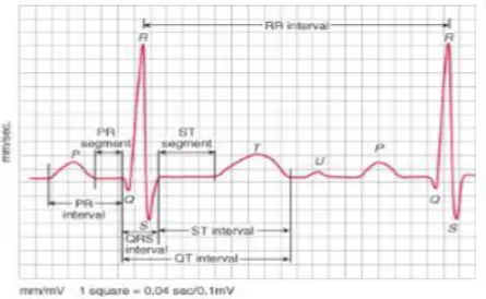 Figure 1 Normal ECG pattern [3] 
