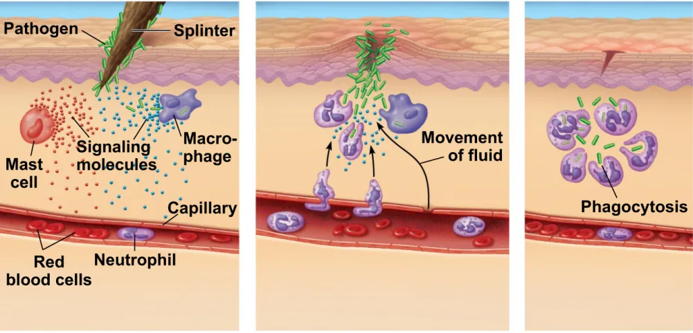 Figure 43.8-3 Pathogen Splinter Mast cell Macro-phage Capillary blood cellsRed