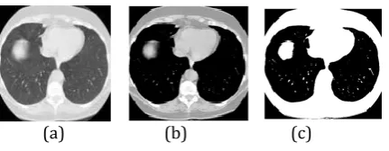 Fig-2: Performance metrics of Classifiers  