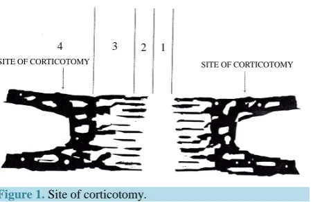 Figure 1. Site of corticotomy. 