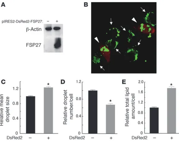 Figure 7Formation of large lipid droplets induced by forced expres-