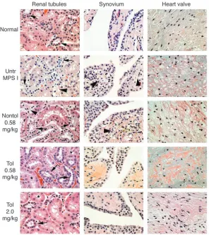 Figure 4Pathologic evidence that immune tolerance to ERT 