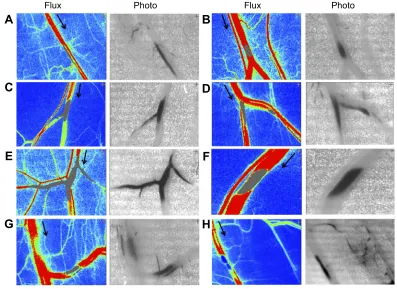 Figure S3 Dynamic retention of MNP with PEG in the representative vessels without magneticdirection of the adjacent vessel