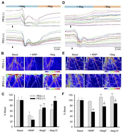 Figure 3 Two-dimensional hemodynamic effects of magnetic capture of PEGylated MNPs in microvessels