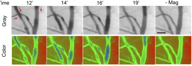 Figure 4 Dynamic retention of MNP with PEG in the representative vessels in magnetic ﬁeld