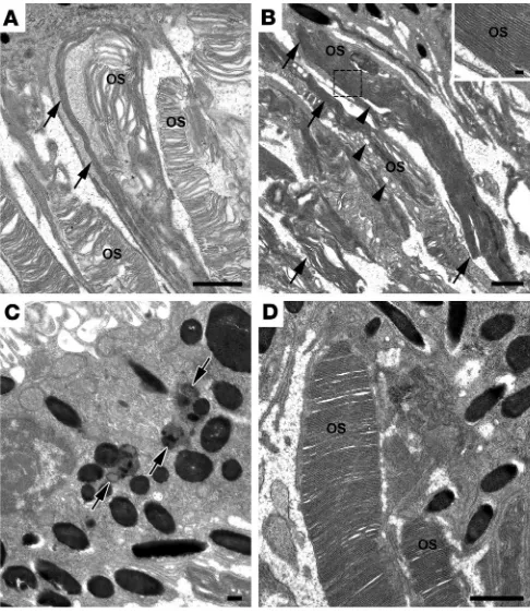 Figure 2Electron microscopy of PROM1 transgenic mouse rod photorecep-tors. (A and B) Overgrown and abnormally oriented disk membranes (arrows) in PMT3 retinas were visible at 16 days (A) and 4 months (B) of age