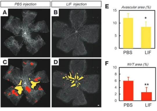 Figure 8Exogenous LIF ameliorates pathological angiogenesis. (