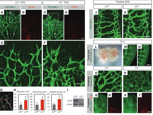 Figure 2Increased microvessel density and sustained tip cell activity in Lif–/– mice. (A–D) Double IHC of PECAM-1 and GFAP in the P4 retinas of Lif+/+ and Lif–/– mice