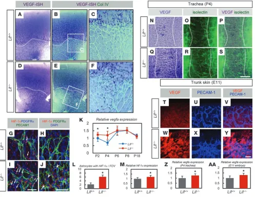 Figure 4Increased VEGF expression in the vascularized area of Lif–/– retina. (A–F) ISH for VEGF combined with IHC for collagen IV