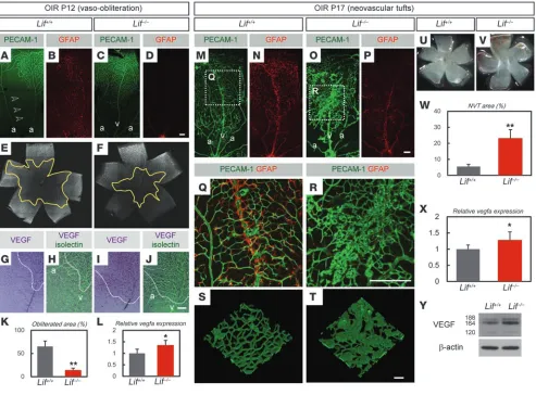 Figure 7LIF deficiency causes resistance against hyperoxic insult and increased extraretinal neovascularization in the OIR model
