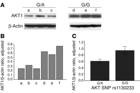 Figure 1AKT1 expression in human lymphoblasts. (A) Representative Western blot images of AKT1 and β-actin protein bands from lymphoblasts of 3 individuals with AKT1 rs1130233 G/A and 3 individuals with G/G