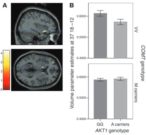 Figure 3Structural neuroimaging. (
