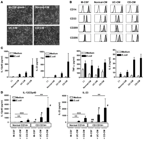 Figure 6The intestinal inflammatory microenvironment affects macrophage differentiation and induces an IL-23–producing phenotype